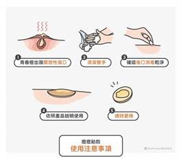 吃什麼可以不長痘痘